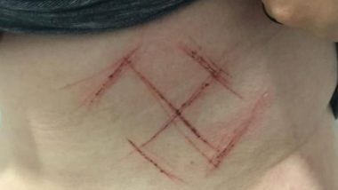 Os cancelamentos são artificiais e eleitoreiros Em 2018, a Polícia do Rio Grande do Sul concluiu que jovem marcada com suástica na pele forjou o crime.
