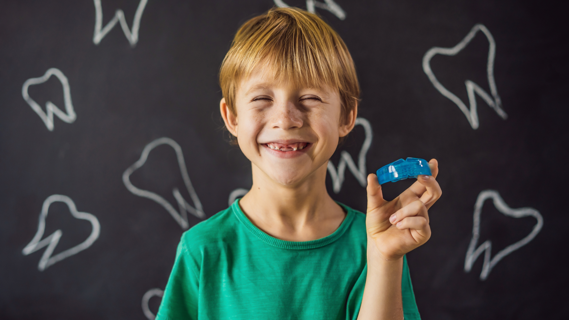 O bruxismo pode ocasionar uma série de problemas para a criança, como o desgaste dos dentes.