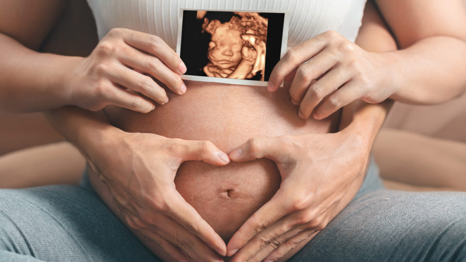 Ultrassom morfológico: 5 fatos que você precisa saber A Primamed tem todo o necessário para auxiliar você e sua família durante o pré-natal. Na foto, um exemplo de fotografia realizada por meio do ultrassom 4D.