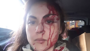 Polícia Civil pede prisão preventiva de procurador que agrediu colega no interior de São Paulo A procuradora-geral do município de Registro (SP), Gabriela Samadello Monteiro de Barros, com o rosto ensanguentado após ser agredida pelo procurador Demétrius Oliveira Macedo.