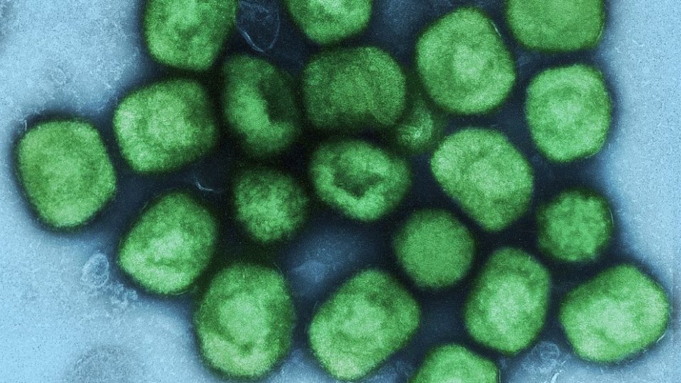 Micrografia eletrônica do vírus da varíola de macaco