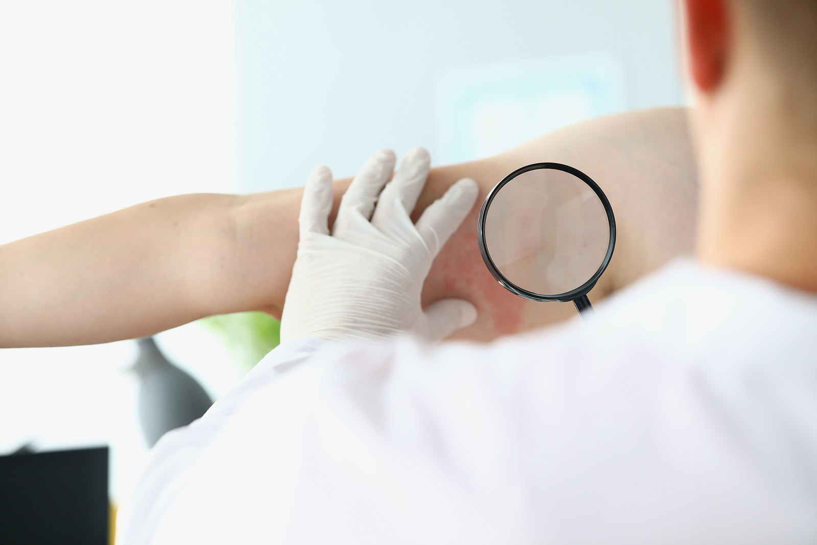 Hanseníase ainda afeta população do Paraná.