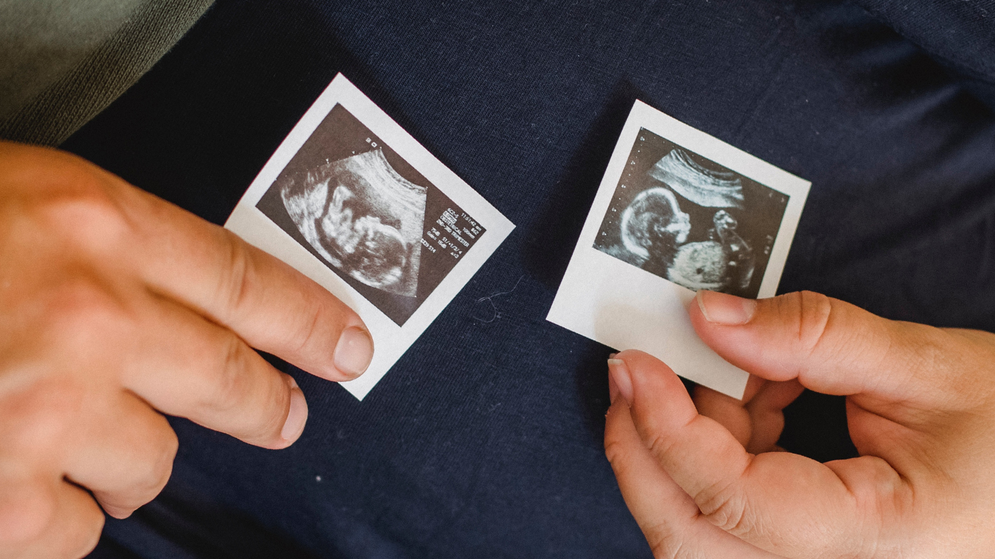 Direito à vida e aborto no Reino Unido