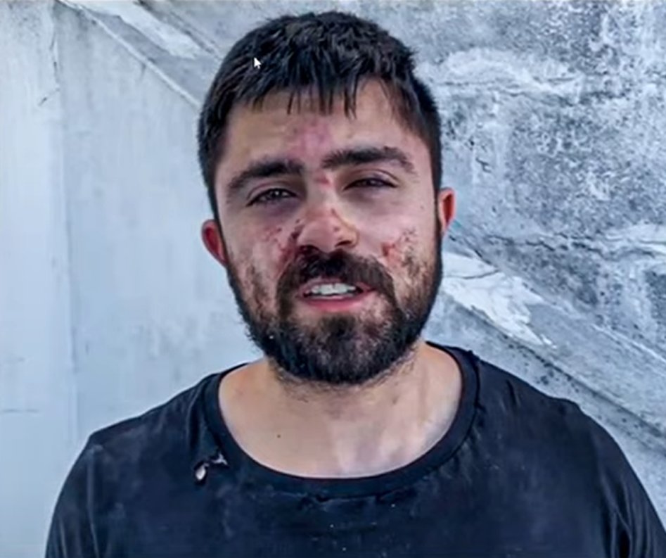 João Bettega, do MBL, foi espancado simultaneamente por quatro agressores, chegou a ficar desacordado e precisou ser conduzido ao hospital após agressão na UFSC, em Florianópolis.