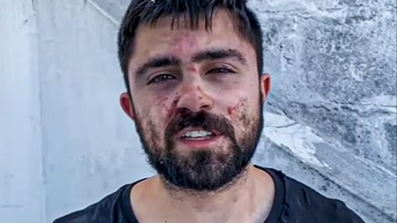 João Bettega foi espancado simultaneamente por quatro agressores, chegou a ficar desacordado e precisou ser conduzido ao hospital