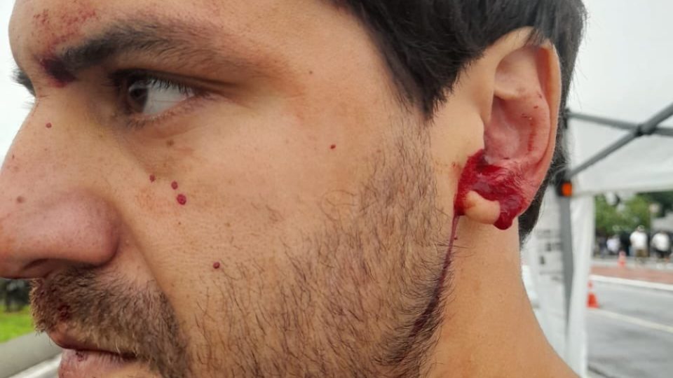 Agressão MBL