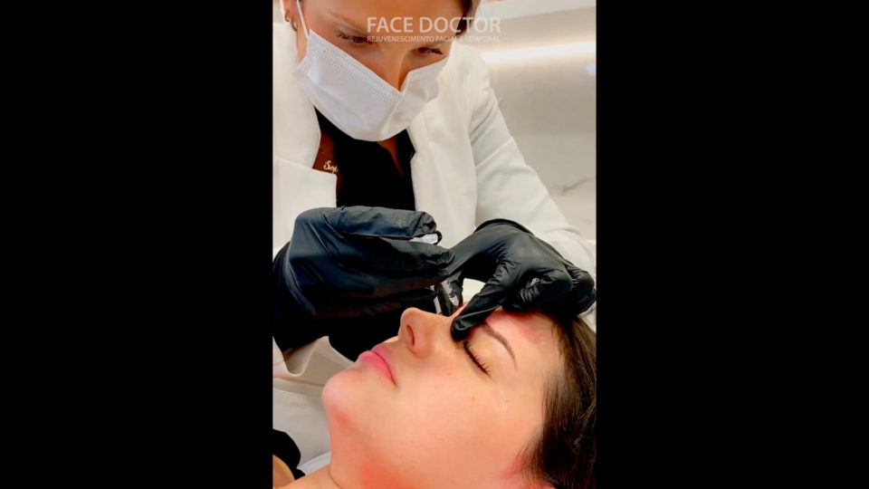 Antes de aplicar o botox, o profissional especializado avalia a necessidade para saber qual a dose de toxina.