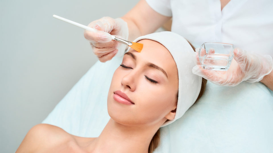 No peeling químico são aplicados ácidos retinóico, salicílico ou outros agentes para remover as camadas superficiais da pele