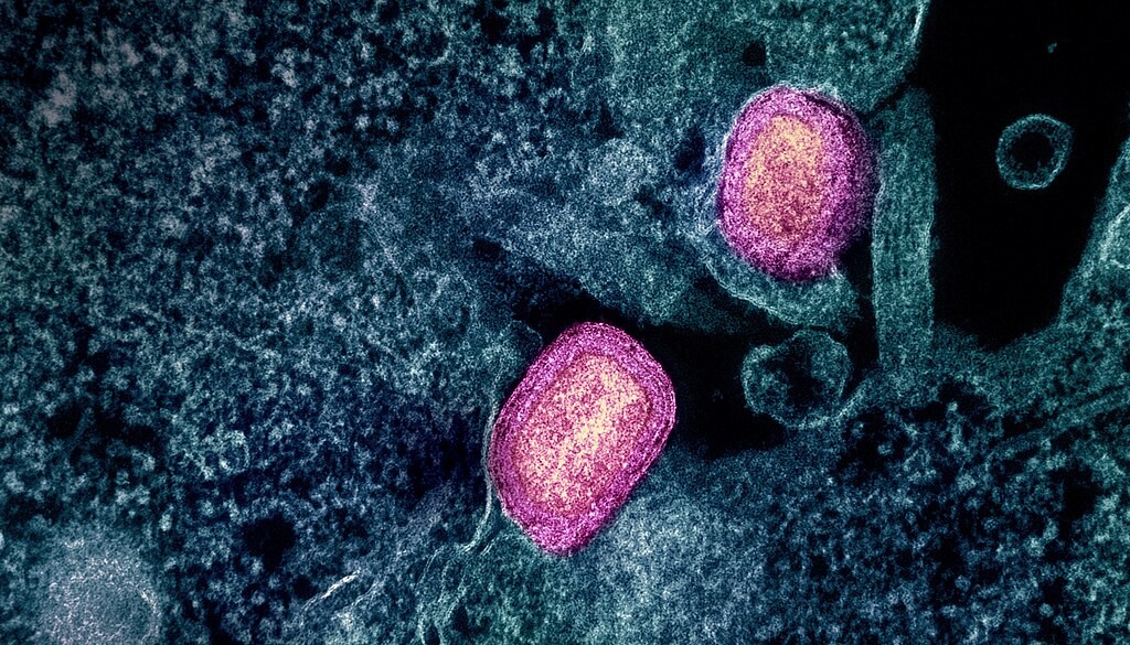 Dois vírus de mpox observados por microscópio eletrônico e coloridos por programa de computador.