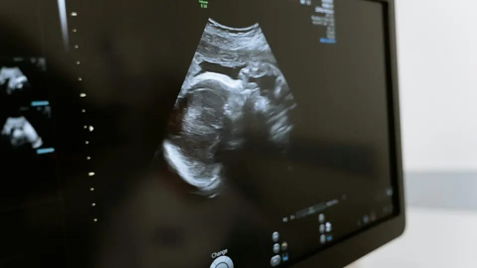 resolucao conanda pec 164 aborto