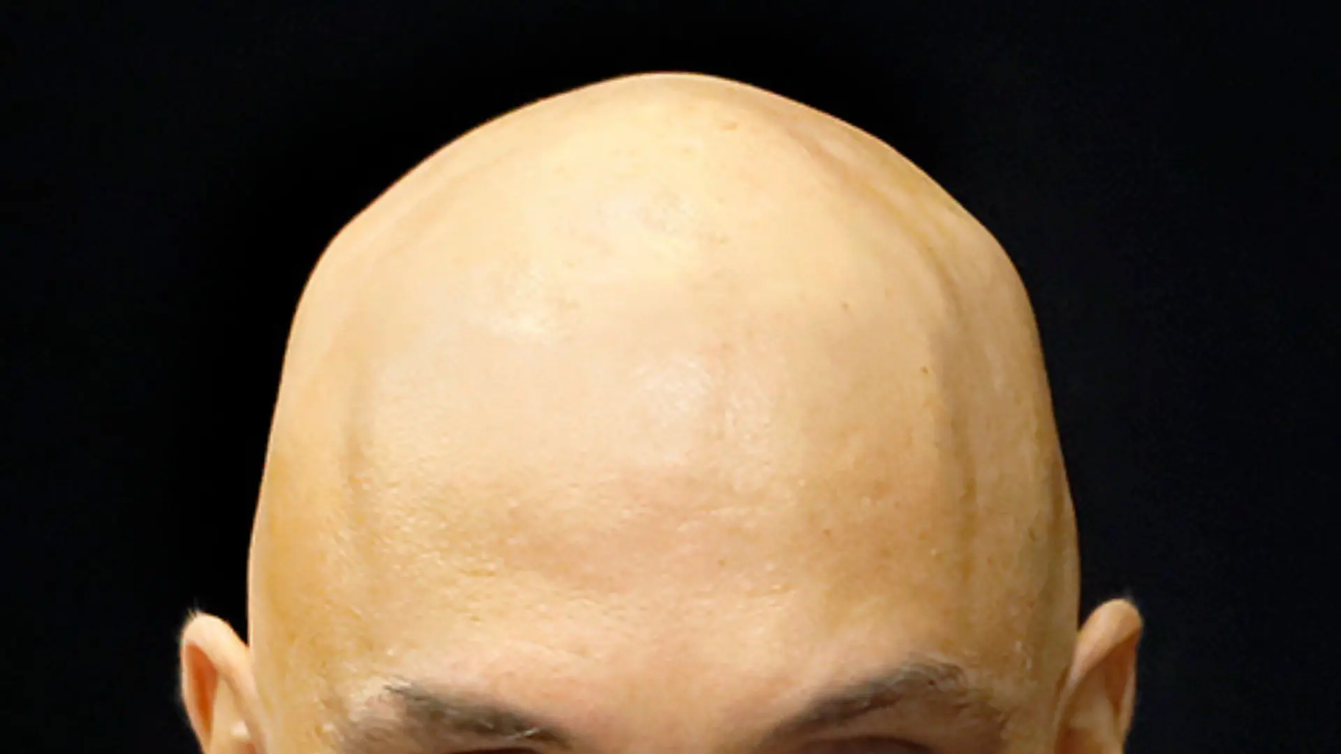 CALVÍCIE ALEXANDRE DE MORAES