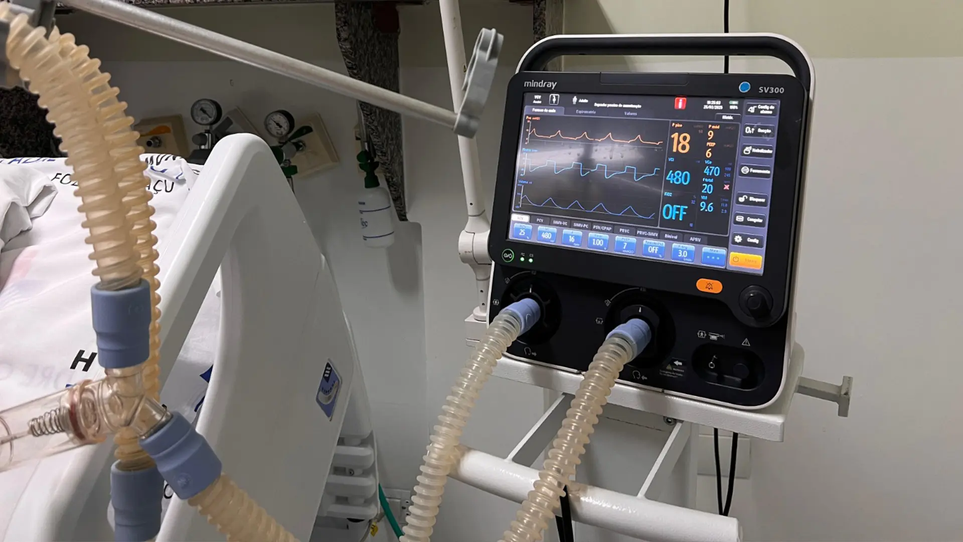 A implantação (IA) na UTI do Hospital Municipal de Foz do Iguaçu permitiu otimizar os processos e a tomada de decisão médica.