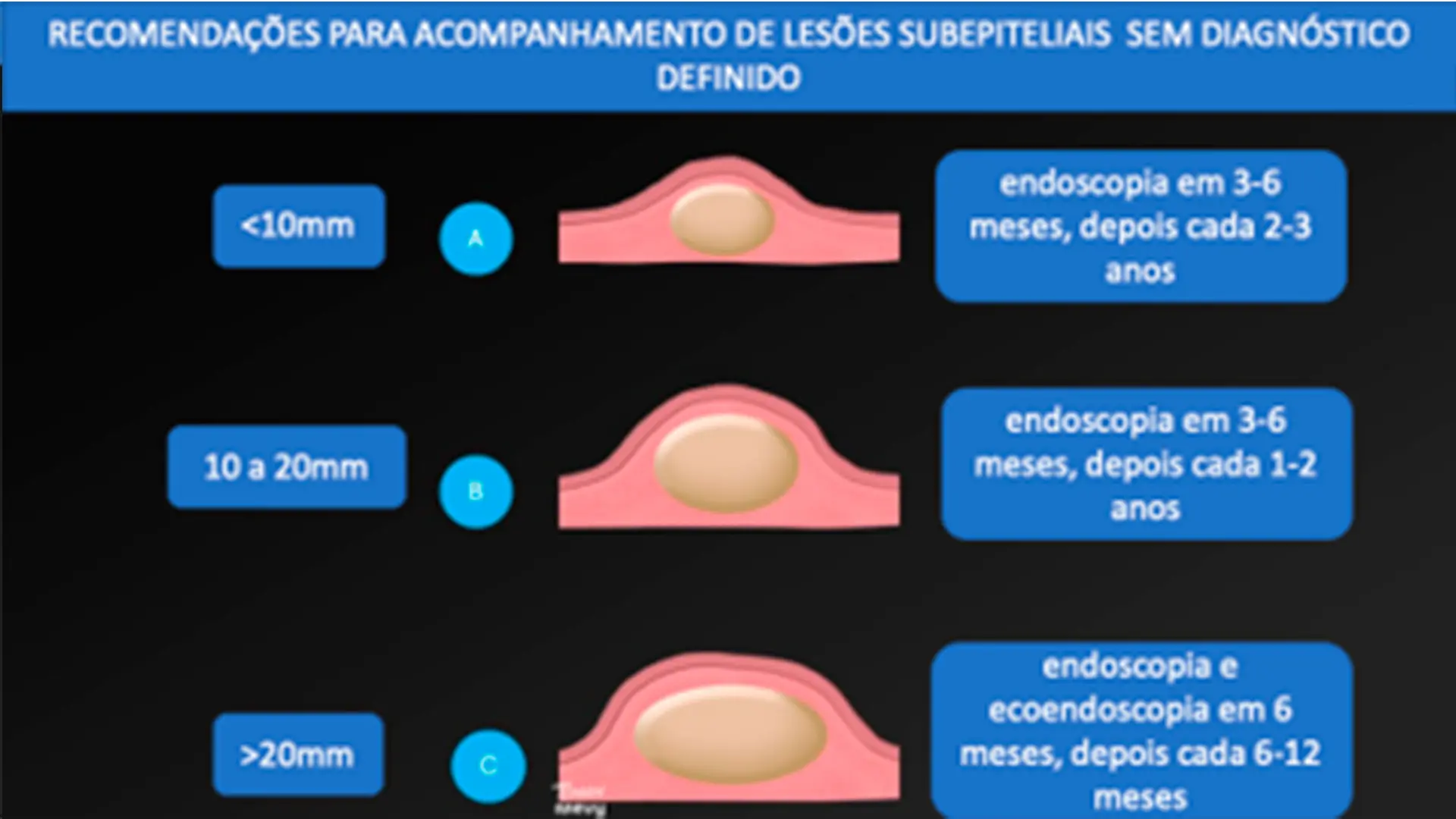 Recomendações para acompanhamento de lesões subepiteliais sem diagnóstico definido. a.lesão menor que 10mm; b.lesão entre 10 e 20mm; c.lesão maior que 20mm.