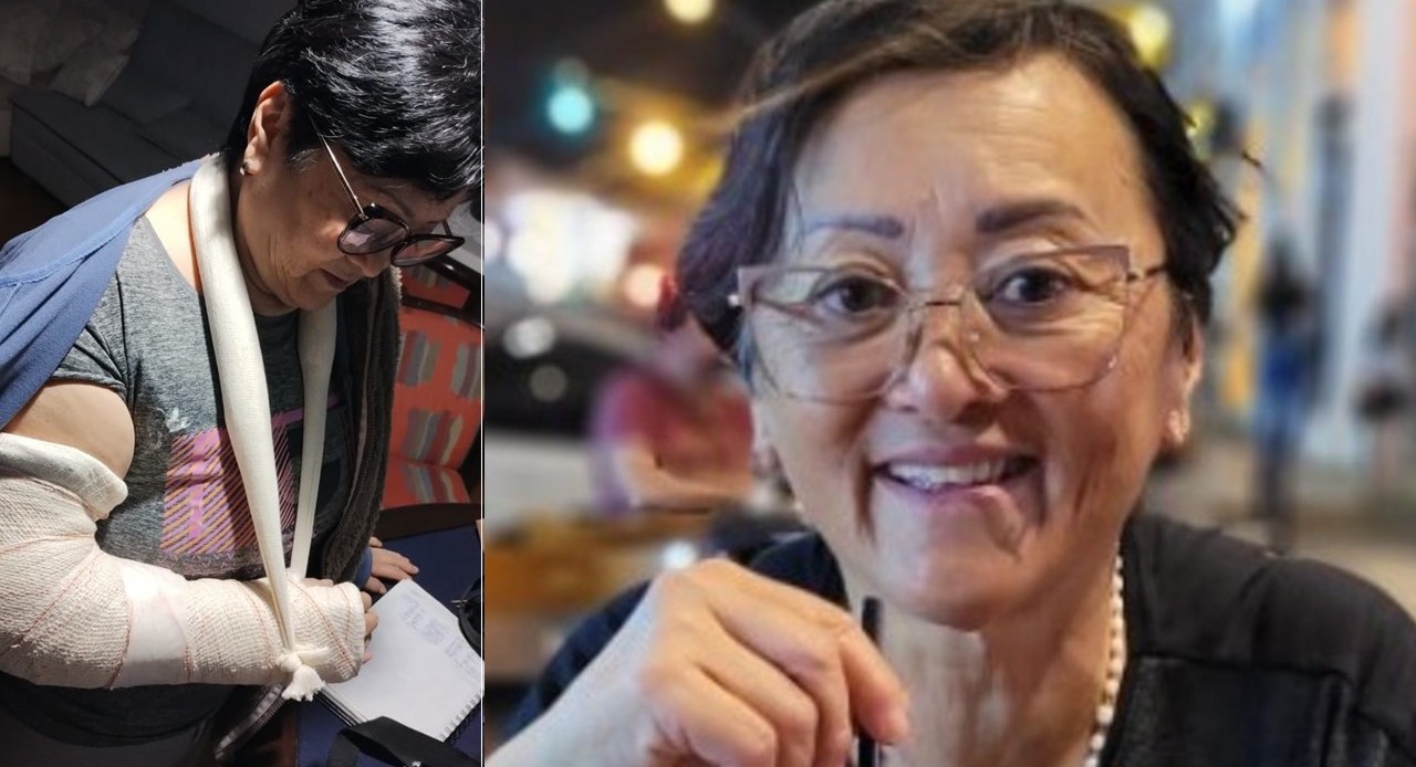 A professora Iraci Nagoshi está com braço engessado devido a um deslocamento no cotovelo; ela também passou por uma cirurgia recente na perna