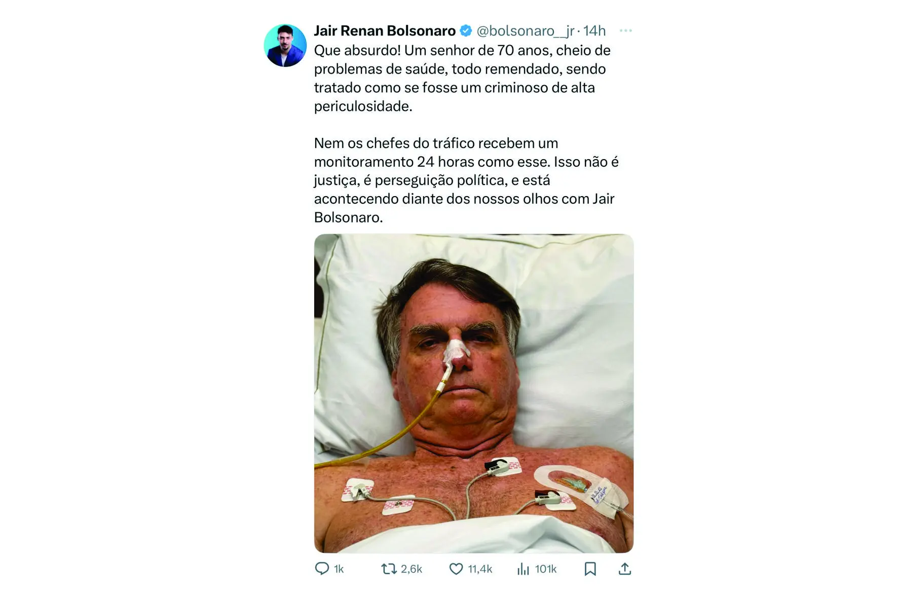 Filho mais novo do ex-presidente Jair Bolsonaro afirma que a nova medida de Alexandre de Moraes trata o pai como se fosse um criminoso de alta periculosidade.