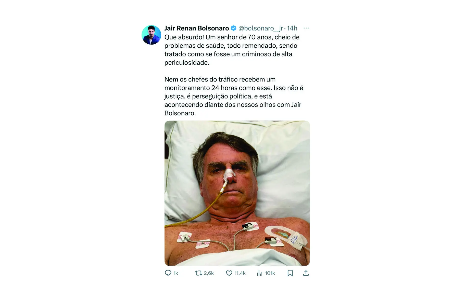 Filho mais novo do ex-presidente Jair Bolsonaro afirma que a nova medida de Alexandre de Moraes trata o pai como se fosse um criminoso de alta periculosidade.