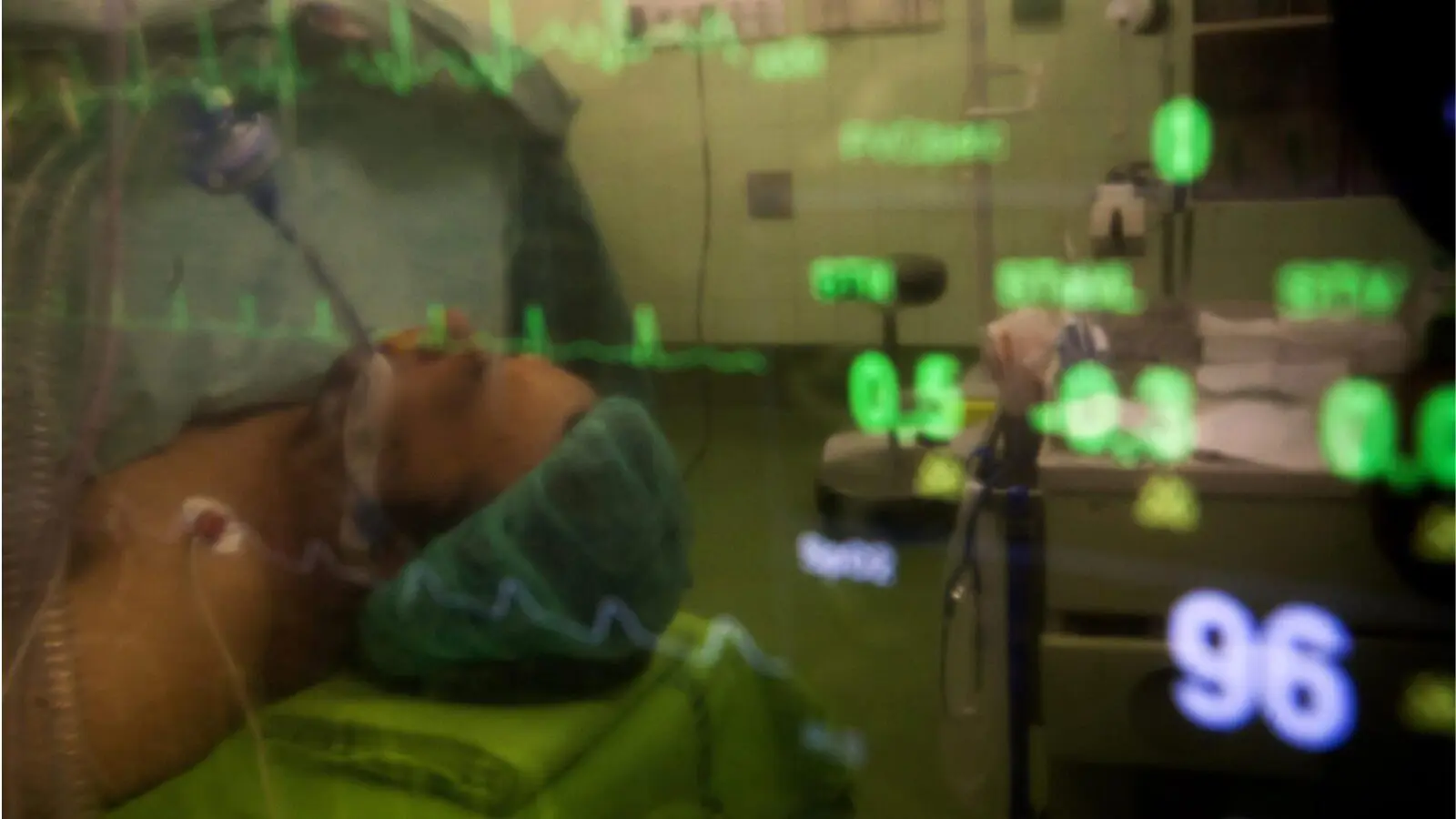 Paciente recebe rim transplantado em Budapeste, na Hungria: caso nos EUA gerou debate sobre normas para doação de órgãos.