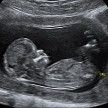 Imagem referente a matéria