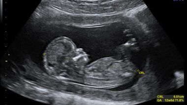 Imagem referente a matéria