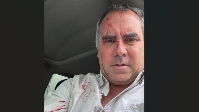 Candidato à Presidência do Peru é alvo de atentado a tiros