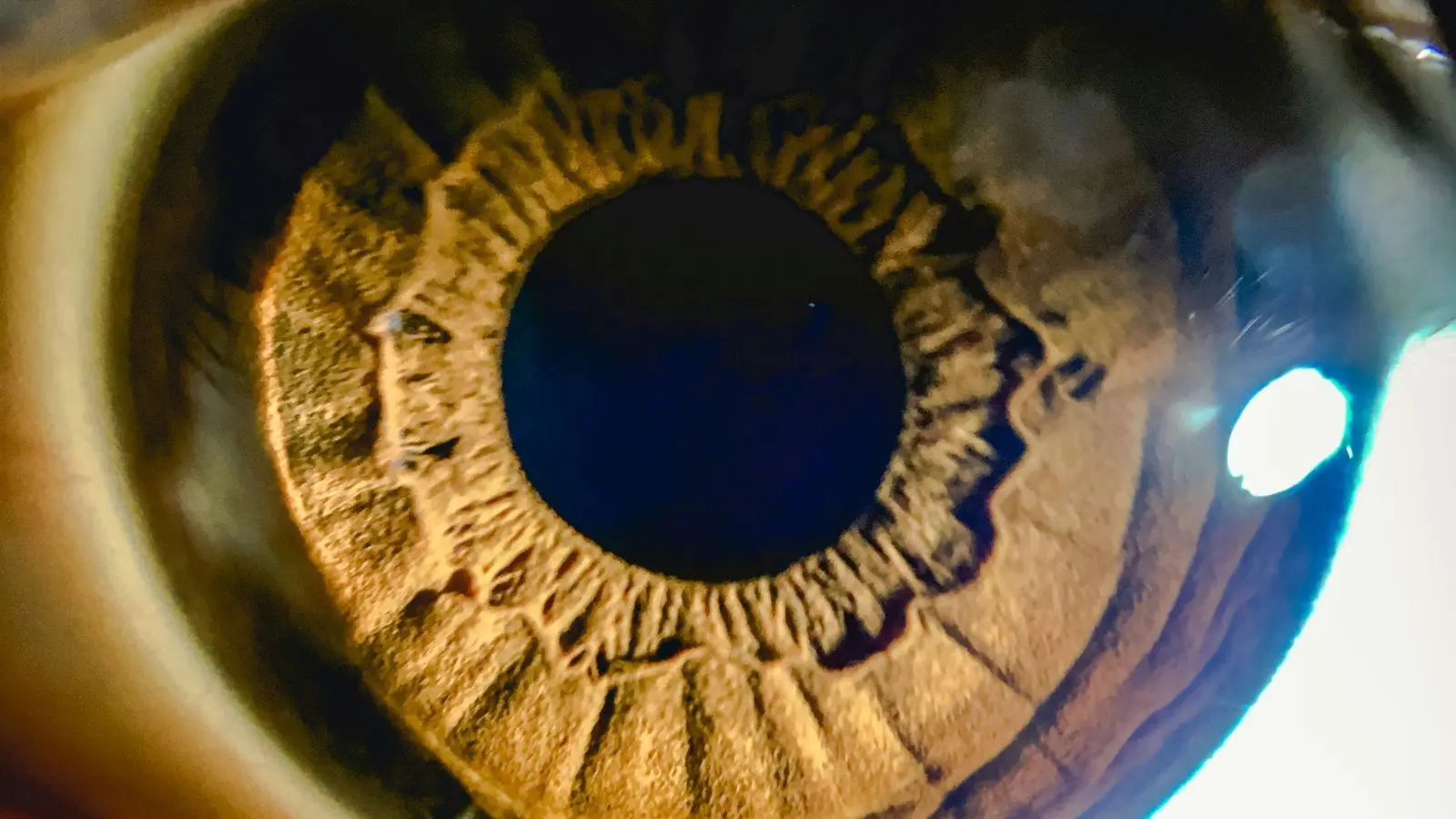 Implante ocular revolucionário, que está em estudo, faz pacientes voltarem a enxergar.