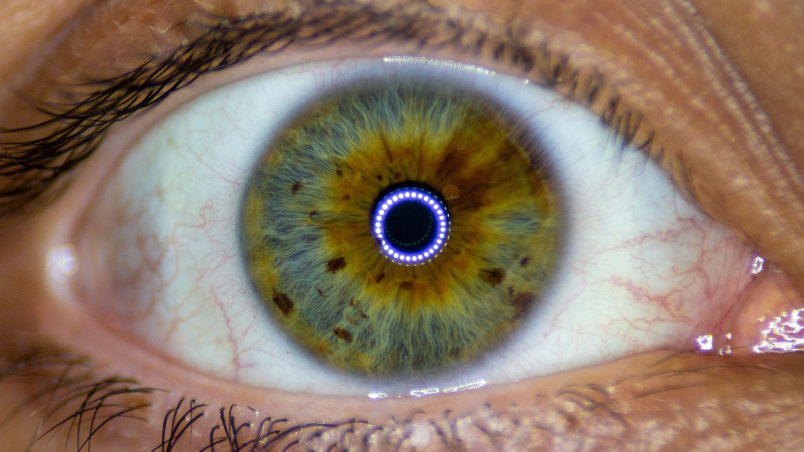 O implante é direcionado a indivíduos com Atrofia Geográfica (AG).