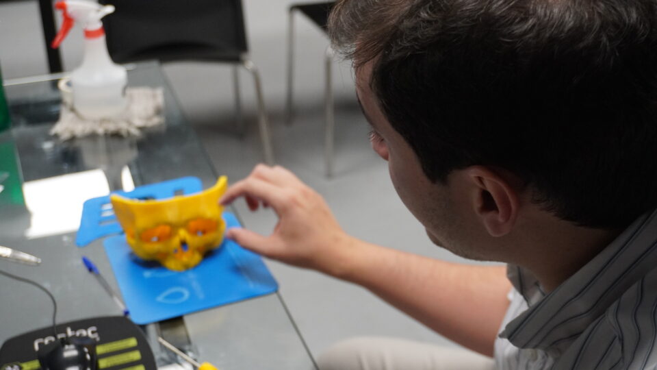 Impressão 3D revoluciona cirurgias oncológicas no SUS e devolve qualidade de vida a pacientes em Guarapuava