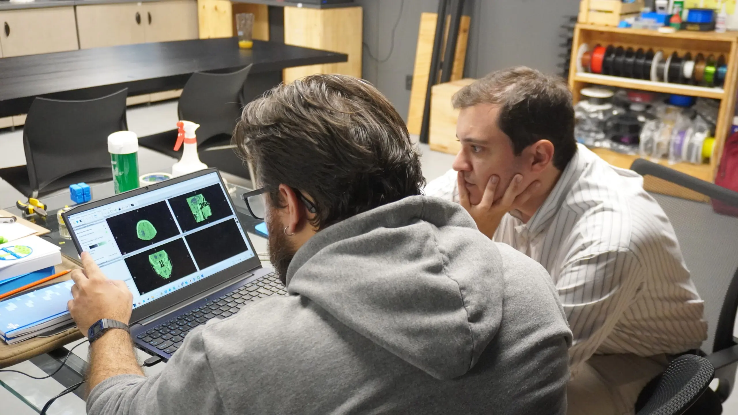 Tomografias e ressonâncias magnéticas se transformam em modelos tridimensionais que ajudam médicos a planejar cirurgias de alta complexidade.
