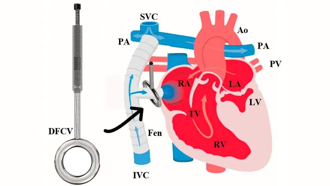 Cirurgia coração