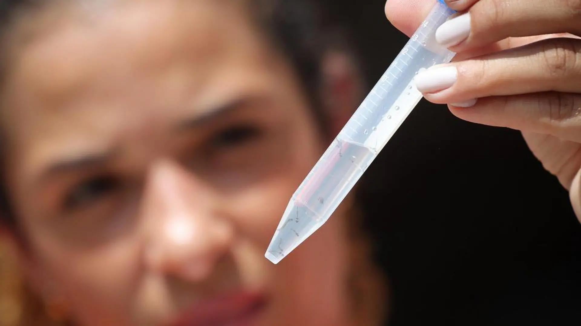 Análise de amostra identifica larvas do mosquito da dengue, evidenciando a importância da vigilância e da eliminação de água parada nas residências.