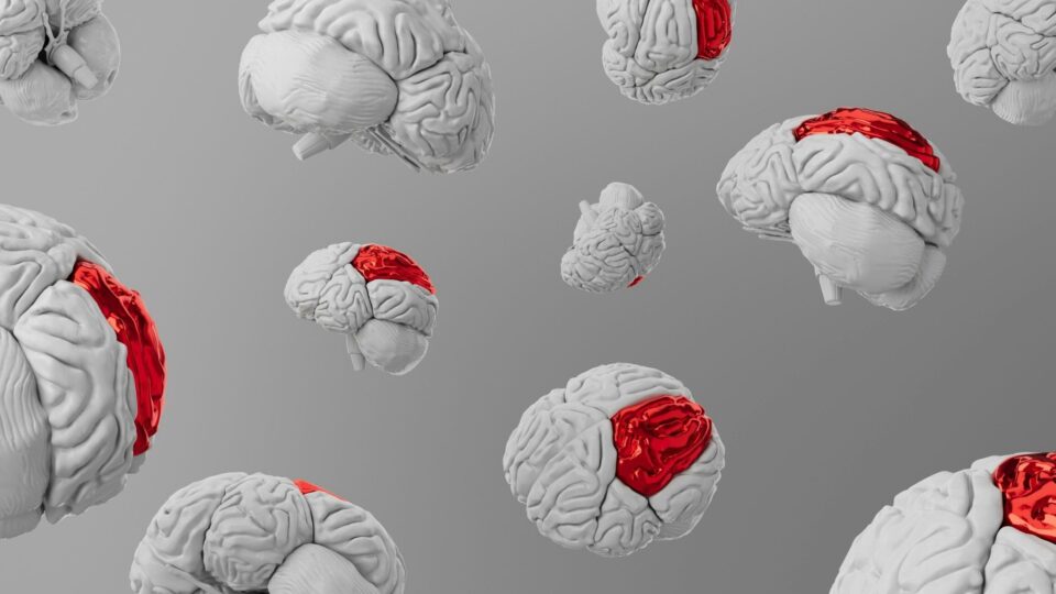 Cientistas japoneses apostam em células-tronco para tratar Parkinson pela primeira vez