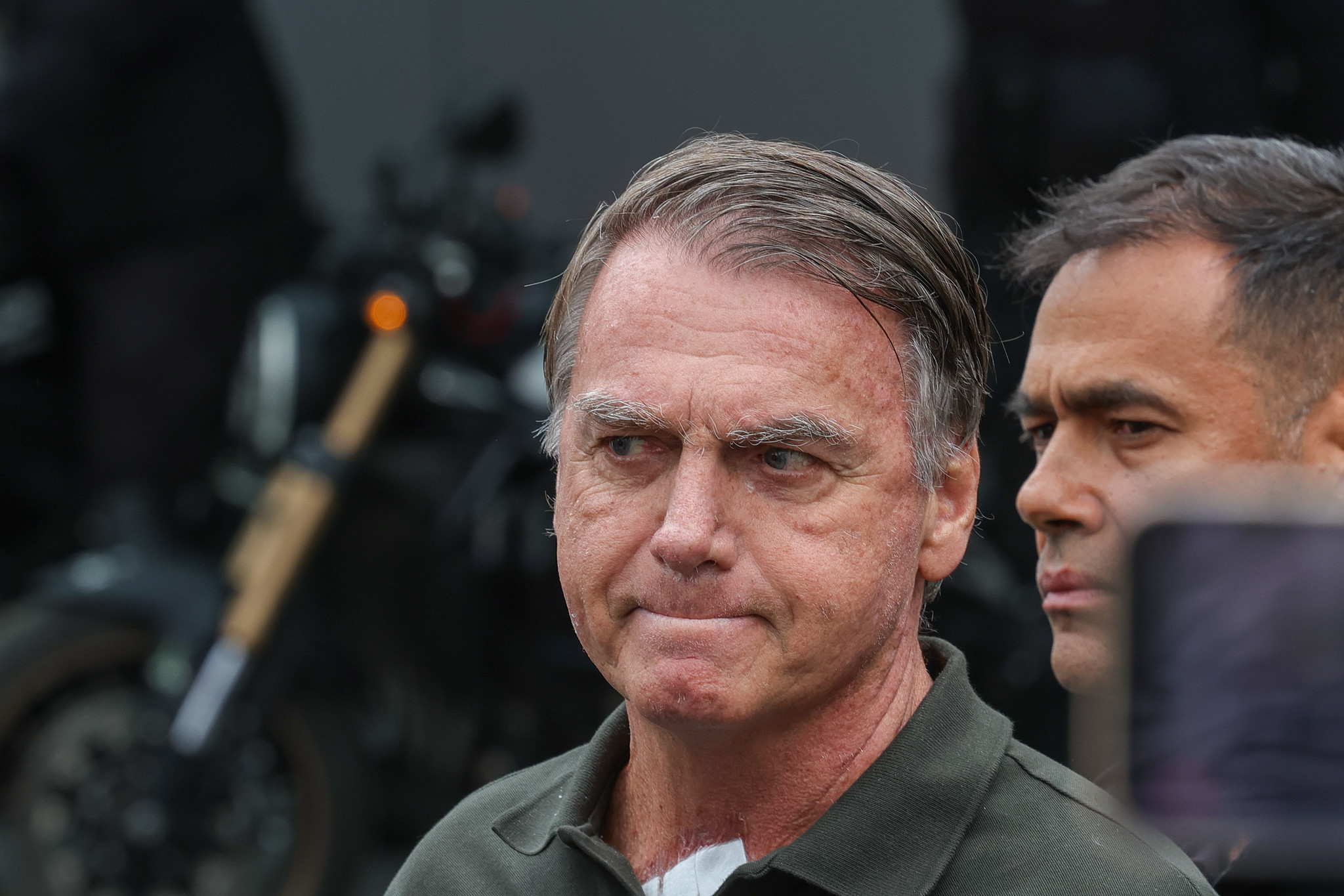 Como está a saúde de Bolsonaro às vésperas de nova decisão do STF?