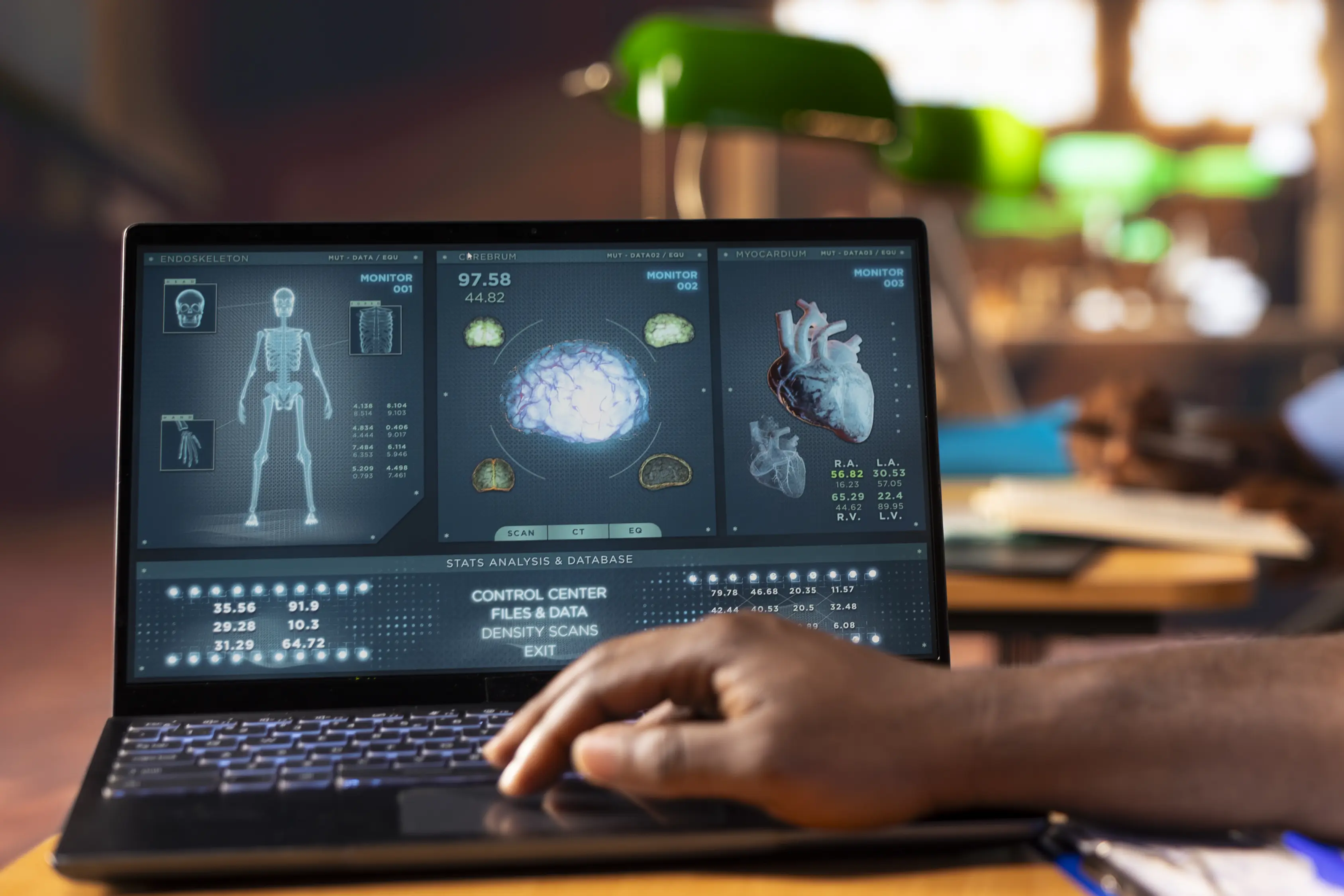 IA atuou de forma integrada às reuniões multidisciplinares da equipe médica (Tumor Board), cruzando dados moleculares complexos em tempo recorde