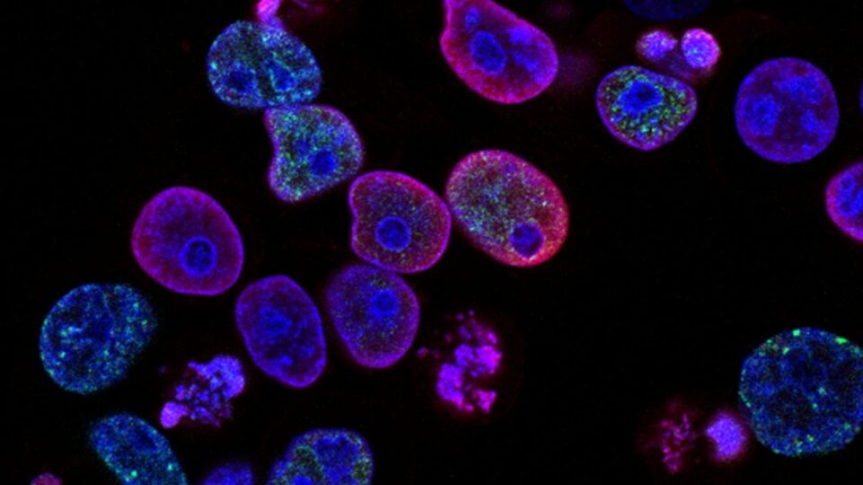 Cientistas descobrem como células cancerígenas “desligam” as defesas do organismo
