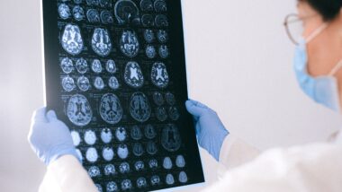 O envelhecimento cerebral envolve mudanças graduais, mas algumas transformações ganham força a partir da meia-idade.
