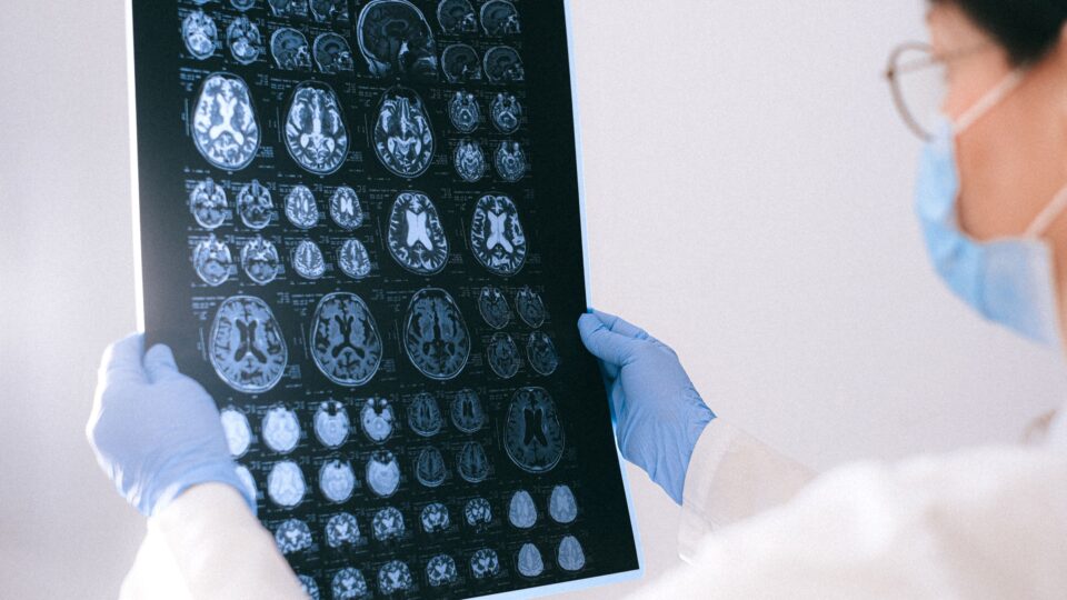 Cérebro entre 50 e 75 anos passa por mudanças que podem explicar o envelhecimento cerebral