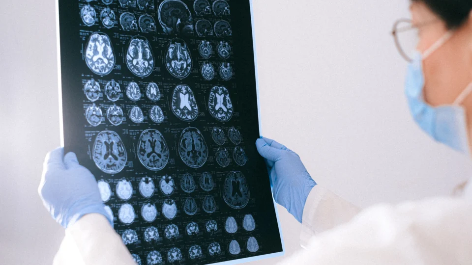 O envelhecimento cerebral envolve mudanças graduais, mas algumas transformações ganham força a partir da meia-idade.