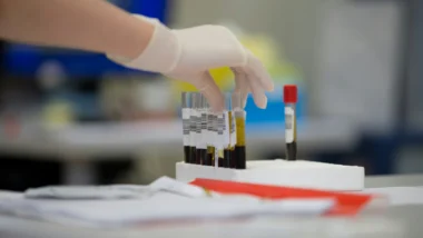 Novo exame de sangue que detecta 50 tipos de câncer busca sinais moleculares da doença antes do aparecimento de sintomas.
