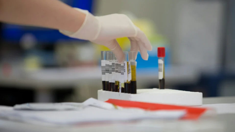 Novo exame de sangue que detecta 50 tipos de câncer busca sinais moleculares da doença antes do aparecimento de sintomas.