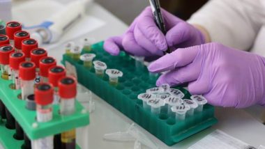 Imunidade contra novo coronavírus pode ter longa duração, apontam novos estudos A resposta imunológica contra o novo coronavírus pode ser de longa duração, indicam estudos recentes