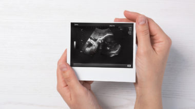 A pergunta temida pelos abortistas No zigoto humano, já estão definidas todas as características biológicas de um ser humano único e irrepetível.