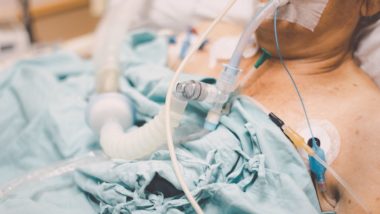 O que significa dizer que alguém morreu por complicações decorrentes da Covid-19 Obesos jovens que morreram por Covid-19 ultrapassam o número de mais velhos com esta comorbidade.