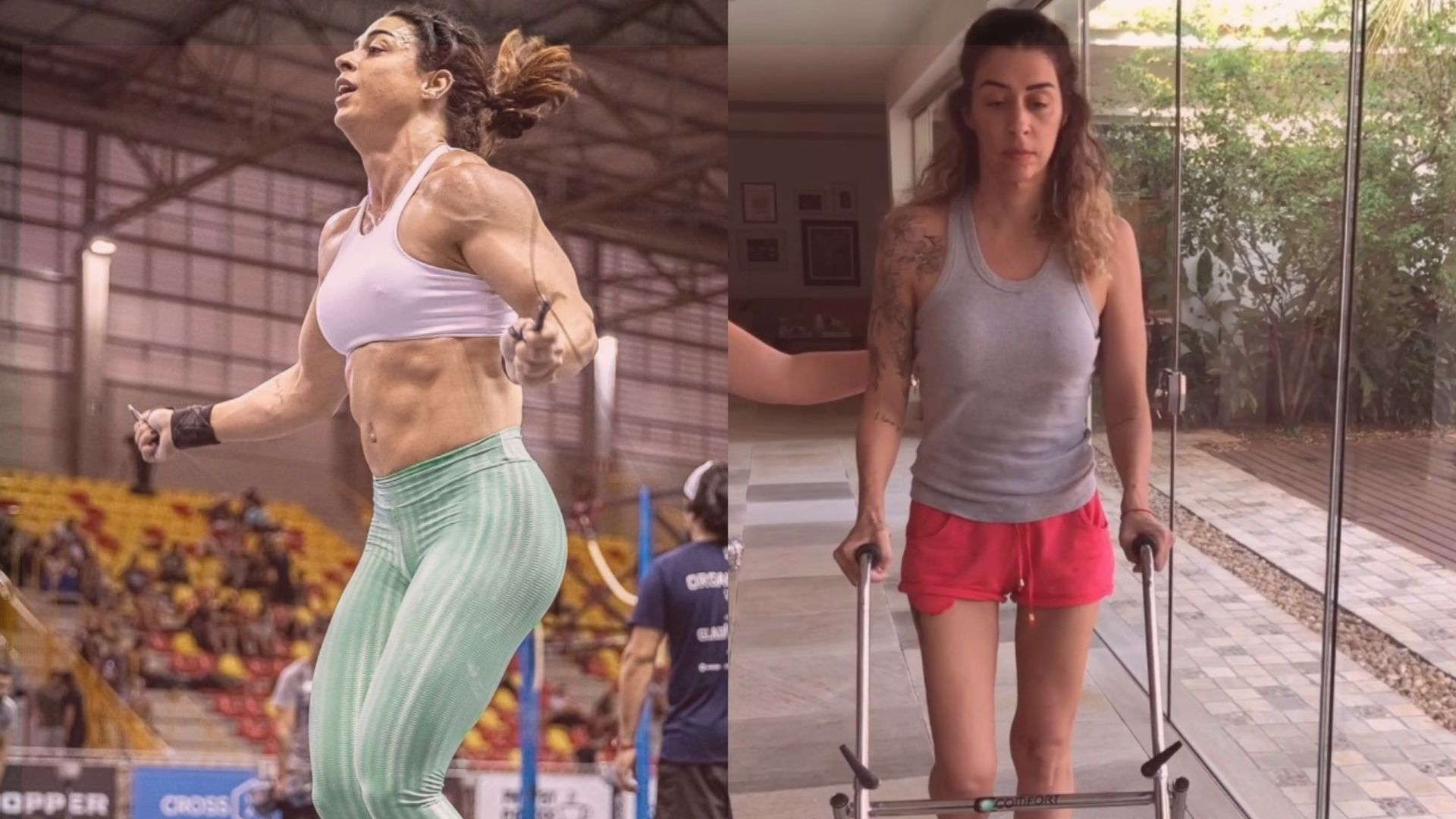 Raquel Trevisi teve 85% dos pulmões comprometidos, foi intubada duas vezes e enfrentou complicações como trombose, infecção no sangue e tetraplegia temporária.