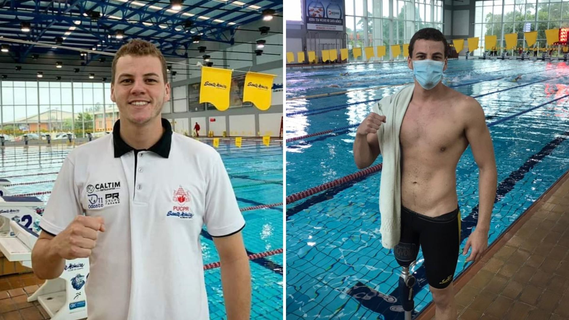 Aos 15 anos João teve a perna amputada, ficou sete dias em coma e 24 internado.