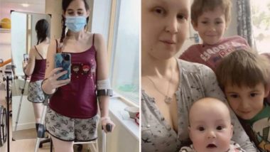 Para não abortar filha, mãe decide amputar perna após diagnóstico de câncer "Estou feliz por ter decidido perder minha perna porque ela me deu minha filha", afirmou a britânica Kathleen Osborne, de 28 anos.