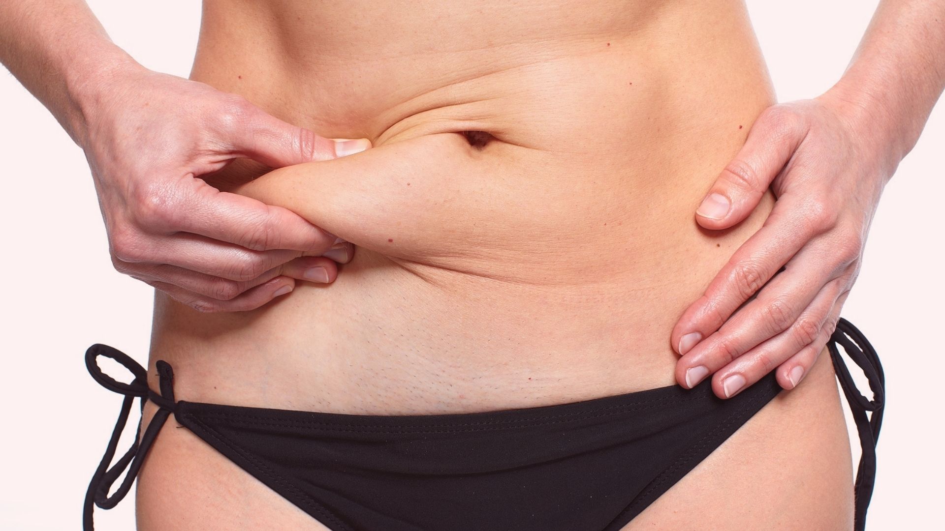 São muitos os cuidados quando se decide seguir para uma cirurgia plástica reparadora pós-bariátrica. Alinhar expectativas é um deles.