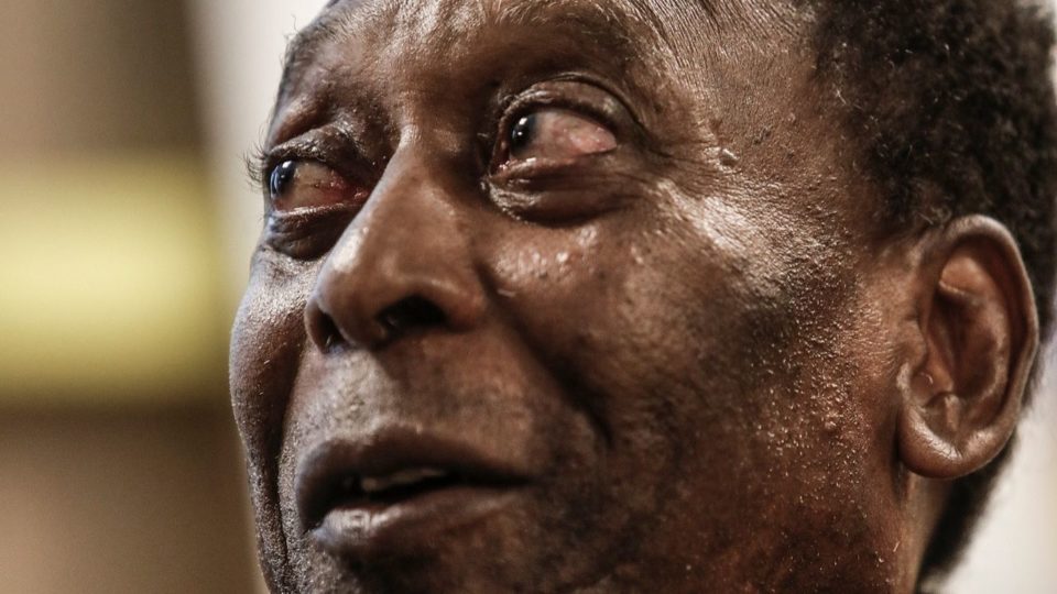 Internado em São Paulo, Pelé passa por cirurgia para retirada de tumor no cólon Internado em São Paulo, Pelé passa por cirurgia para retirada de tumor no cólon