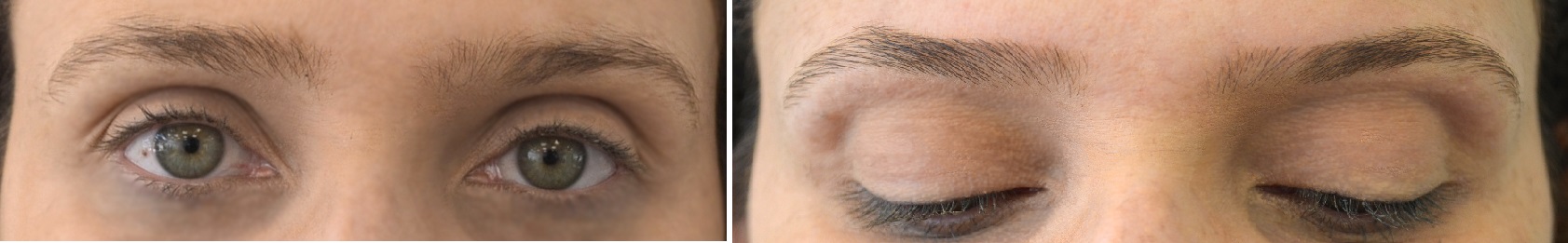 O que é microblanding? A nova técnica promete deixar as sobrancelhas com um ar mais natural O que é microblanding? A nova técnica promete deixar as sobrancelhas com um ar mais natural