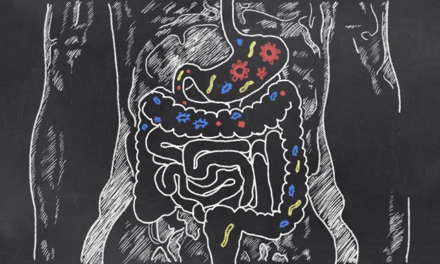 O transplante se tornou uma forma de terapia para casos persistentes de infecção por Clostridium difficile.
(Foto: Bigstock) O transplante se tornou uma forma de terapia para casos persistentes de infecção por Clostridium difficile.
(Foto: Bigstock)