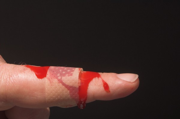 Hemofilia afeta mais homens que mulheres; saiba quais são os sinais e sintomas (Foto: Bigstock)
